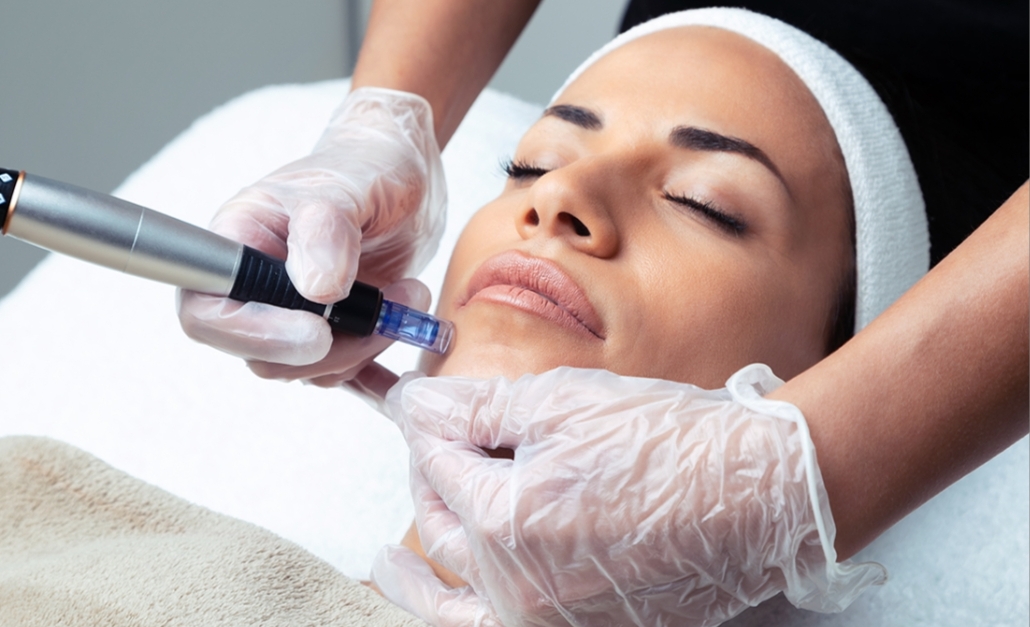 Microneedling