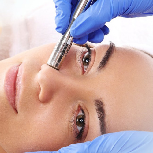 Microdermabrasion Facial